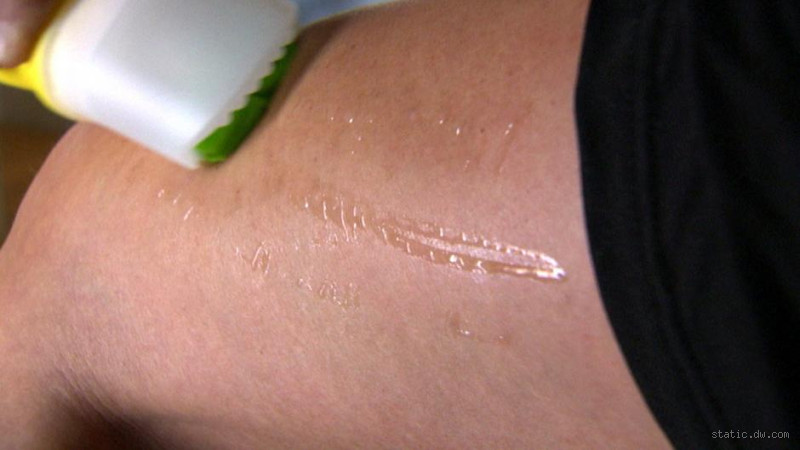 هل السيلوليت يزعج الرجل؟ الحقيقة التي لا تعرفها