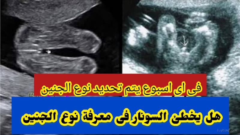 هل يمكن أن يتغير نوع الجنين بالدعاء؟ الحقيقة وراء هذا السؤال