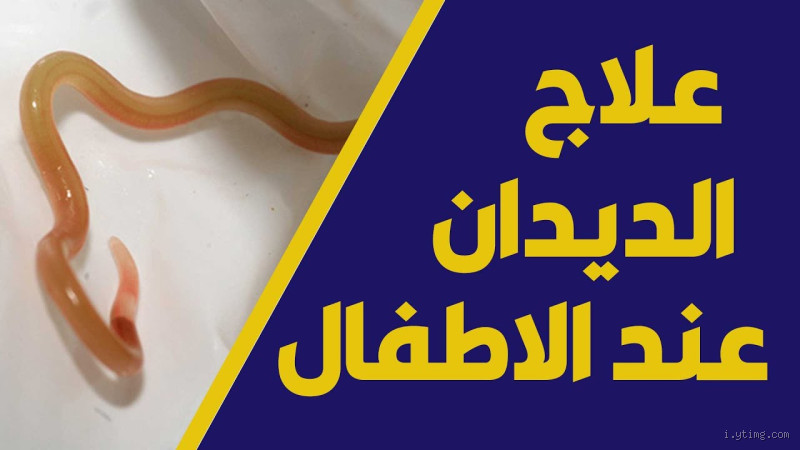هل الديدان تسبب حرقان؟ تعرف على الأسباب والعلاج