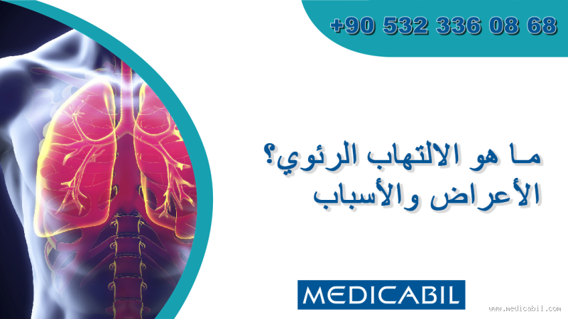 هل الالتهاب الرئوي يدخل في غيبوبة؟ كل ما تحتاج معرفته عن هذا المرض