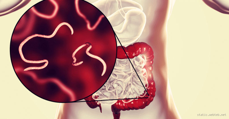 هل من الممكن ان تخرج الدودة الدبوسية مع البراز؟