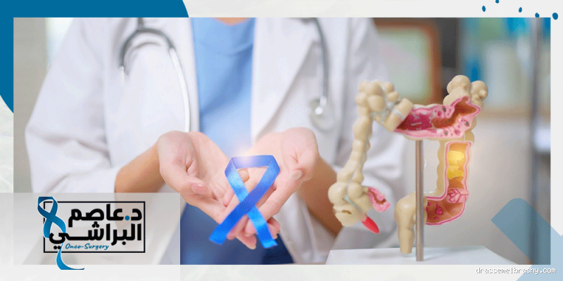 هل يمكن الشفاء من القولون نهائياً؟ الحقيقة وراء هذا السؤال