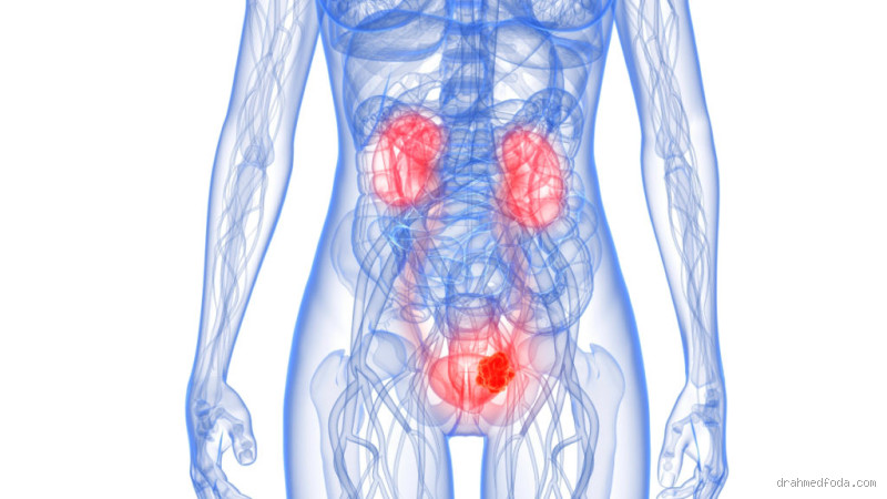 هل يسبب التهاب المسالك البولية ألم في الخصية؟ اكتشف الحقيقة