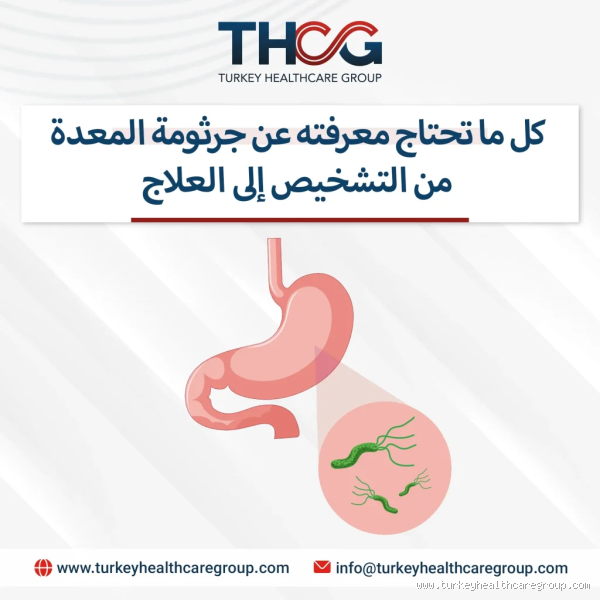 كم نسبة الشفاء من جرثومة المعدة؟ كل ما يجب معرفته