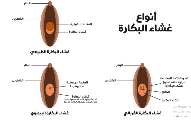 كيف نعرف أن الغشاء ممزق؟ الأعراض والتفسير الطبي