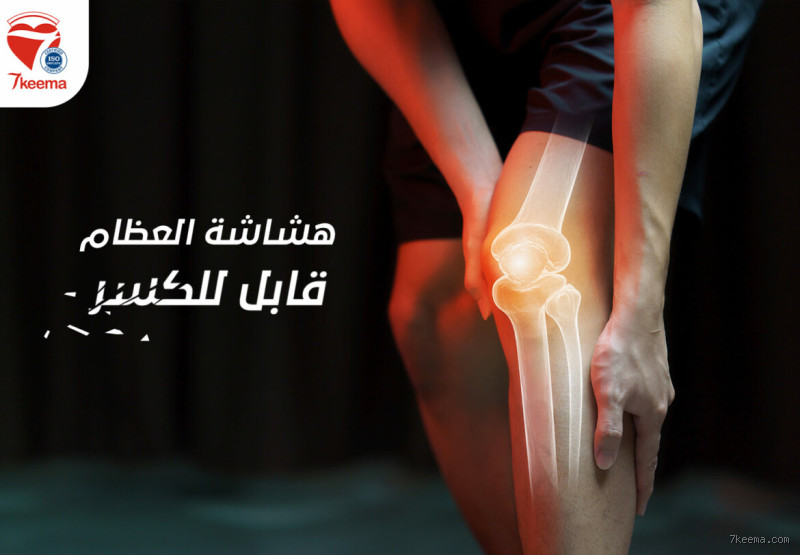 ألمت في المشي؟ هل من الضروري معالجة هشاشة العظام؟