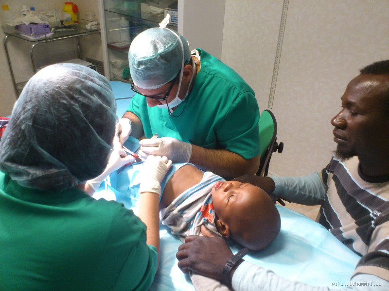 متى هو أفضل وقت لإجراء عملية الختان؟