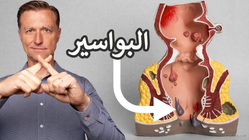 ما هو أقوى مسكن للبواسير؟ راحة حقيقية أم وهم مؤقت؟