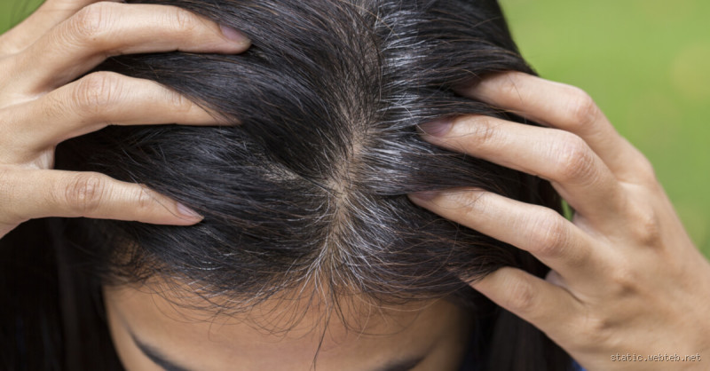 ما هو سبب كثرة الشيب؟ الأسباب والحلول المدهشة التي لم تعرفها