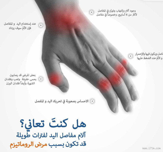 ما هو سبب وجع اليدين والرجلين؟ تعرف على الأسباب والعلاج