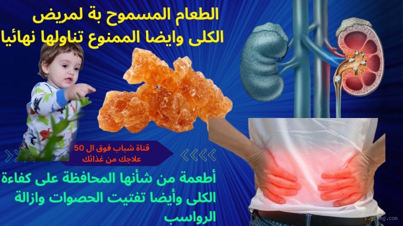 ما هي الأكلات الممنوعة لمرضى الكلى؟ تعرف على الأطعمة التي يجب تجنبها