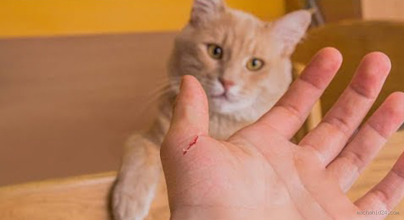 ماذا تفعل عضة القطة في اليد؟ تعرف على المخاطر والآثار المحتملة
