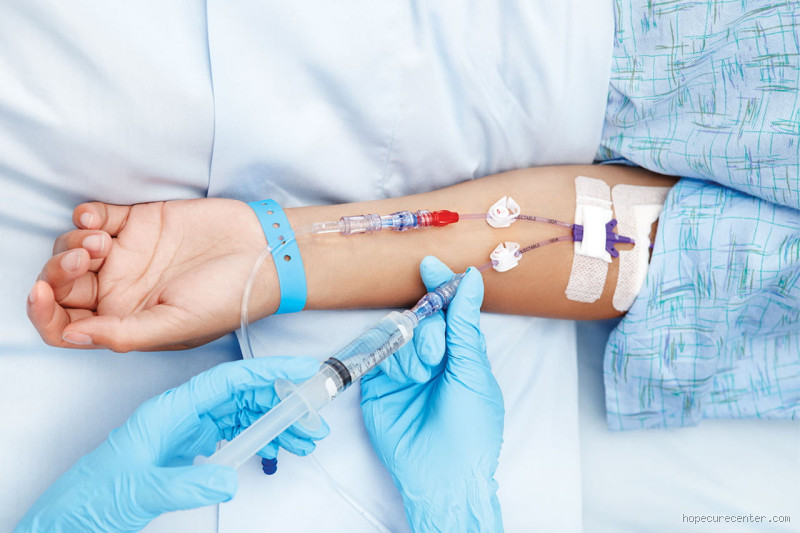 متى يبدأ العلاج الكيماوي بعد الاستئصال؟ (كل ما تحتاج معرفته)