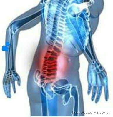 هل مرض الديسك يؤثر على الانتصاب؟ اكتشف الحقيقة وراء العلاقة